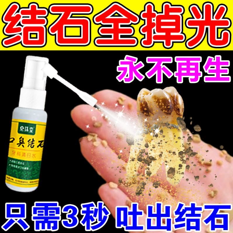 去除牙结石专用喷剂速效溶解牙石除口臭祛牙垢清洁黄渍神器非牙膏