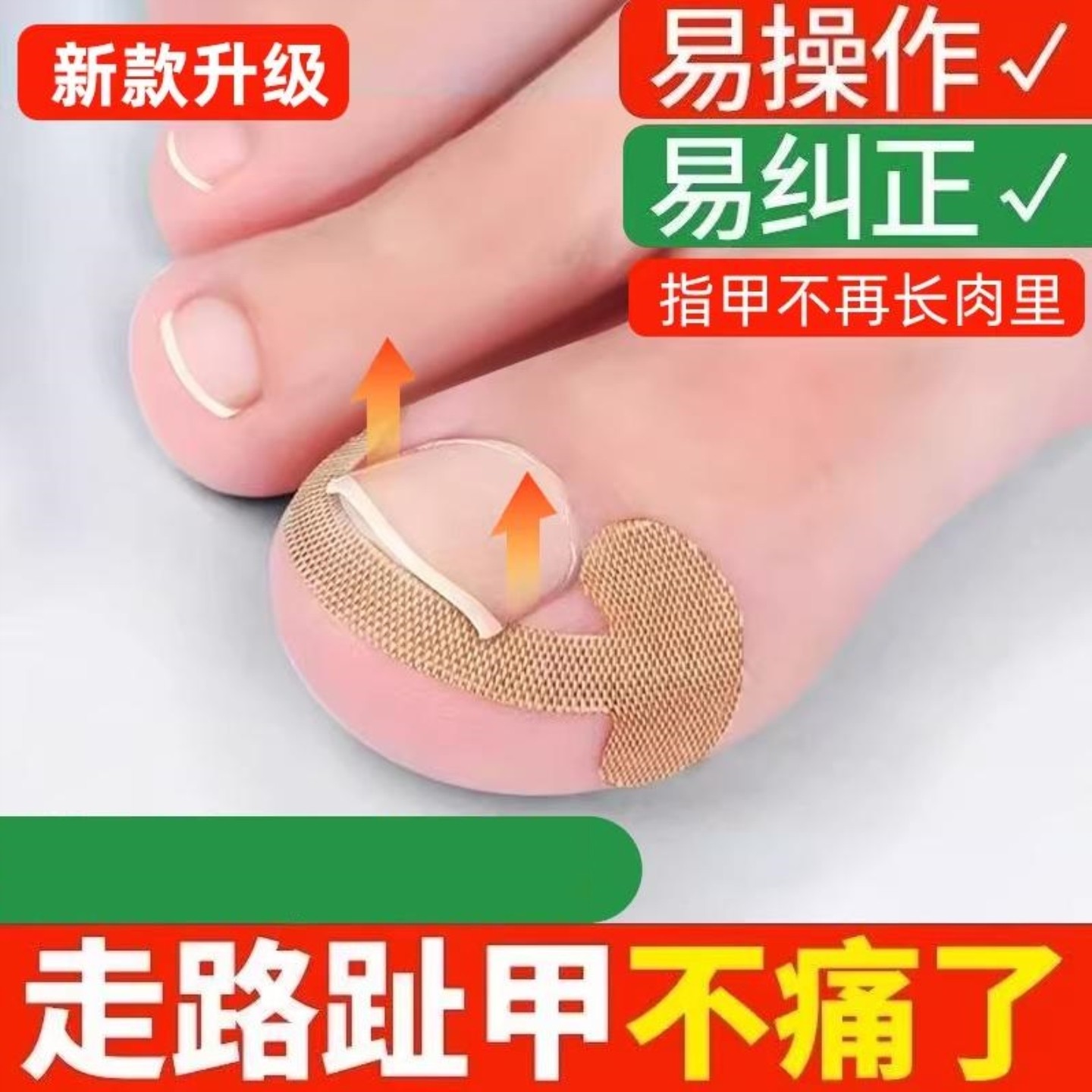 甲沟矫正器正甲贴片炎嵌甲防止脚趾甲长肉里专用隔离填充正甲垫片,家庭/个人清洁工具,美甲/修甲套装,淘宝优惠券,粉丝福利购,淘宝优惠卷