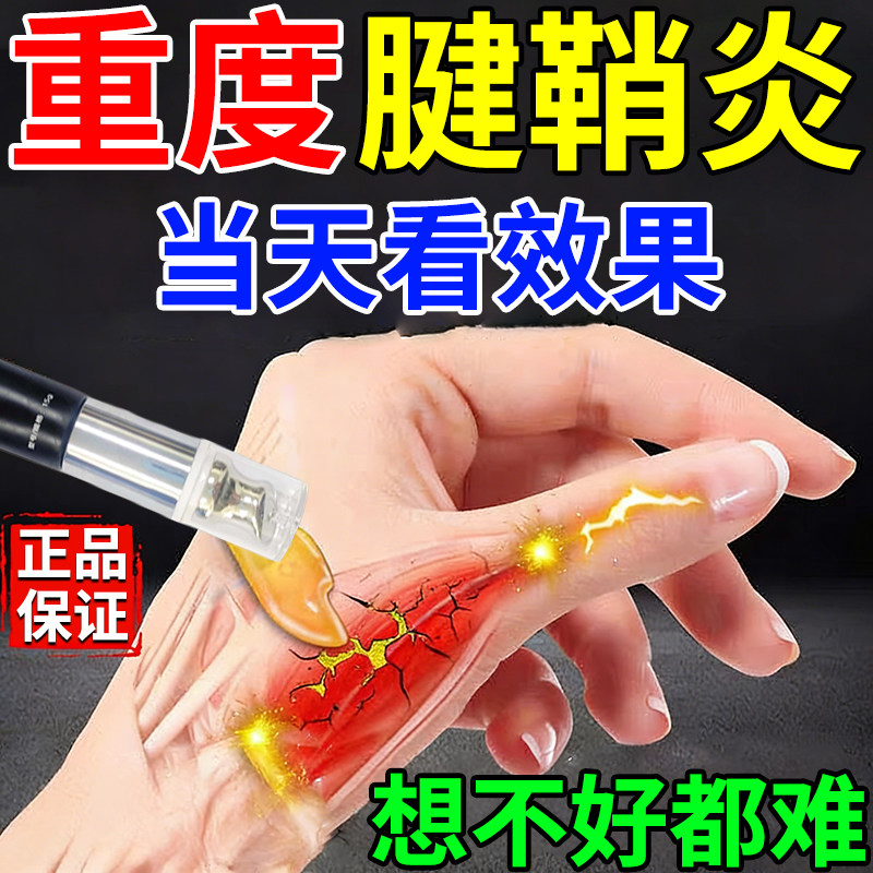 腱鞘炎专用凝胶手指关节疼痛