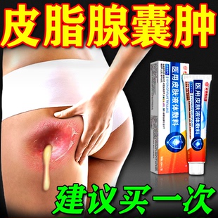 内廷上用拔毒膏火疖子脓包疙瘩皮脂腺囊肿专用软膏脓头化脓去硬块