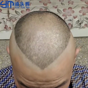 郭德纲成人理发模具同款头型大人发型郭德纲桃心短发剃头辅助神器