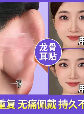 精灵耳贴强支撑龙骨反复使用拍证件照耳朵定型隐形变小脸荔树同款