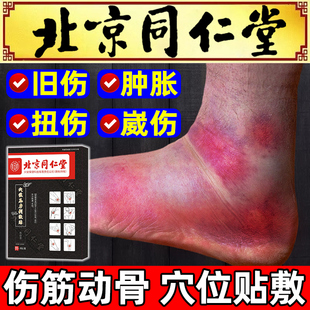 伤筋动骨膏药跌打损伤北京同仁堂脚踝扭伤崴脚老伤活血化瘀热敷贴