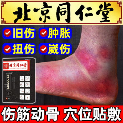伤筋动骨膏药跌打损伤热敷贴