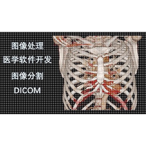 医学图像处理DICOM图像、图像分割、深度学习人工智能、软件开发