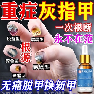 灰指甲阿莫罗凤仙花芬搽剂抑菌液日本进口药一滴净药水正品