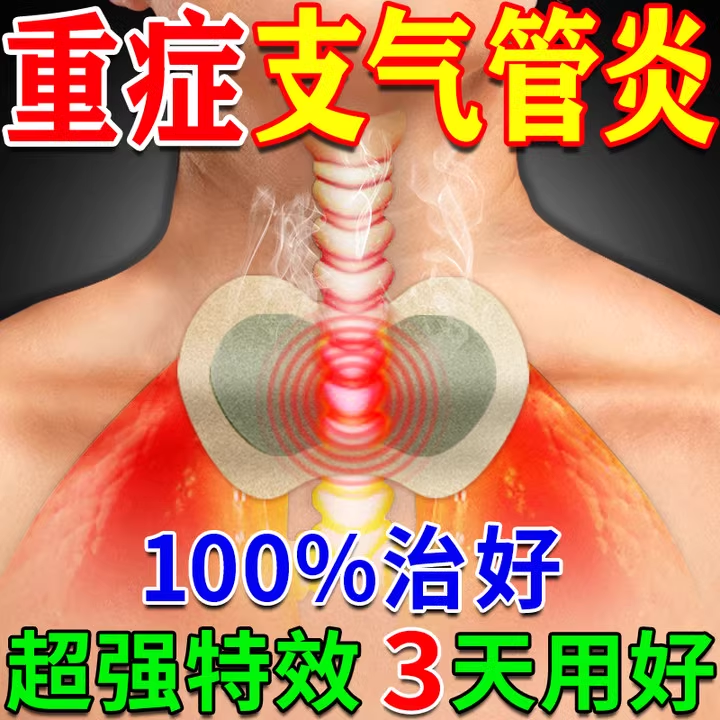 慢性支气管炎治i根清肺化痰进口专用i药哮平喘止咳祛痰贴特用神器