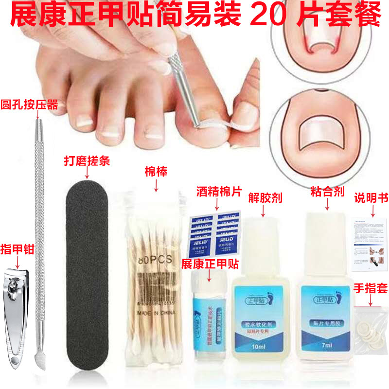 展康正甲贴 嵌甲矫正贴片 拉拉贴 脚趾甲贴弹片简易装厂批,家庭/个人清洁工具,美甲/修甲套装,淘宝优惠券,粉丝福利购,淘宝优惠卷