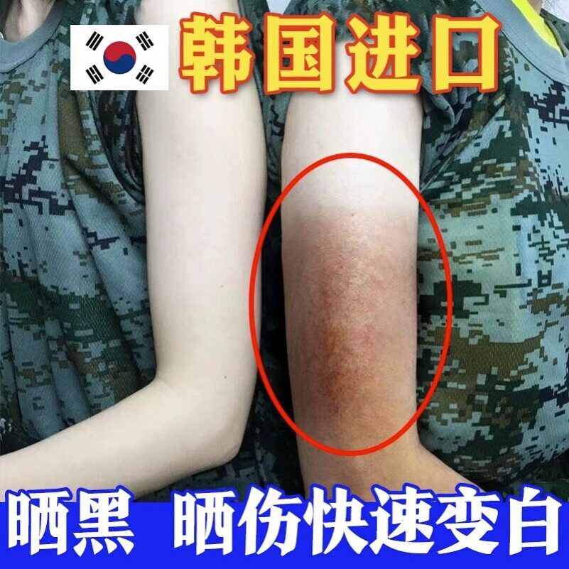 晒黑了皮肤晒伤晒后军训修复黑怎么快速变白霜女士男士美白乳面部