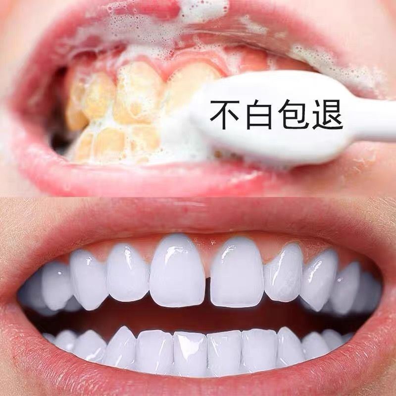 牙白神器【去黄口臭牙结石】洁牙慕斯泡沫牙膏学生美白牙齿脱色剂