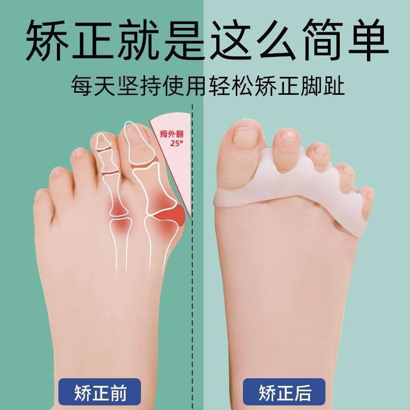 小孩分趾器弯曲大脚骨男女士日用拇外翻脚指头宝宝脚