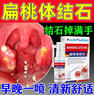扁桃体结石去除喷剂清理工具隐窝冲洗器口腔咽喉异物漱口水吸取出