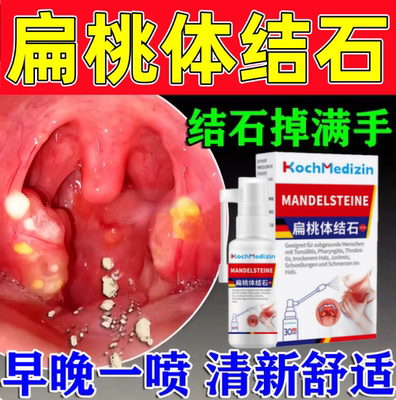 扁桃体结石去除喷剂清理工具隐窝冲洗器口腔咽喉异物漱口水吸取出