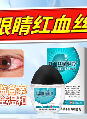 眼白发黄眼睛清澈去黄红血丝眼药水抗疲劳眼睛充血改善眼红血丝WT