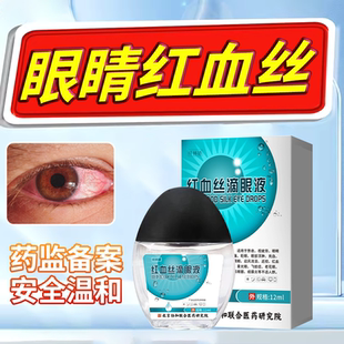 眼白发黄眼睛清澈去黄红血丝眼药水抗疲劳眼睛充血改善眼红血丝WT