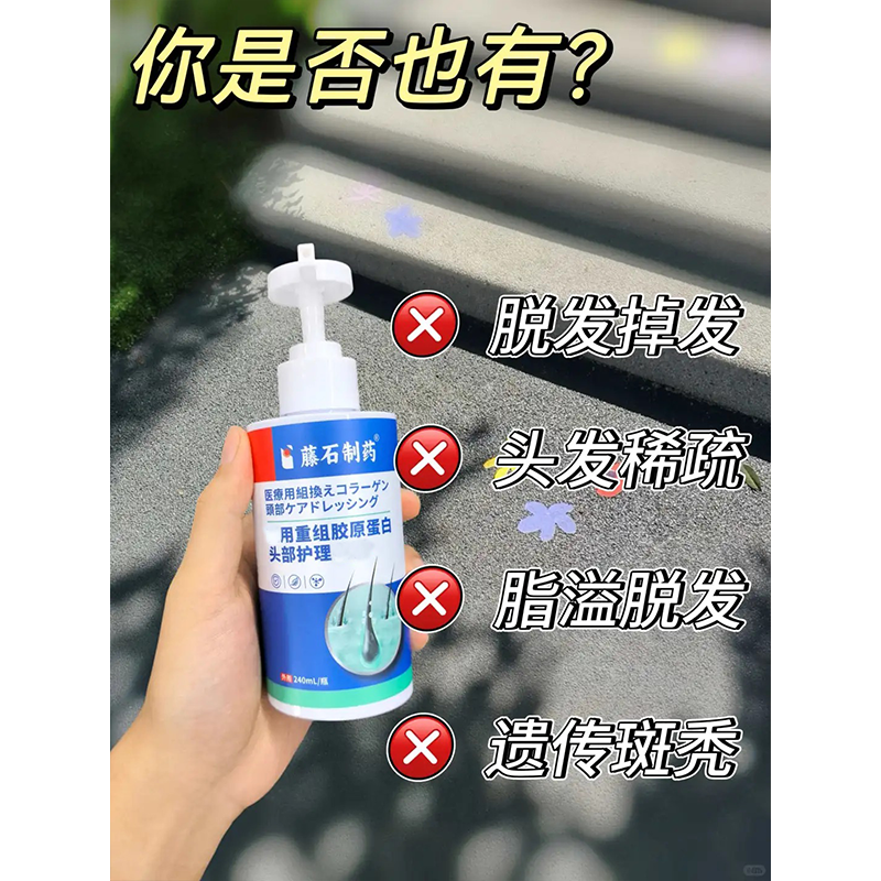 专斑秃用洗发水脱发严重防鬼剃头毛囊修护掉发头发稀疏ZR