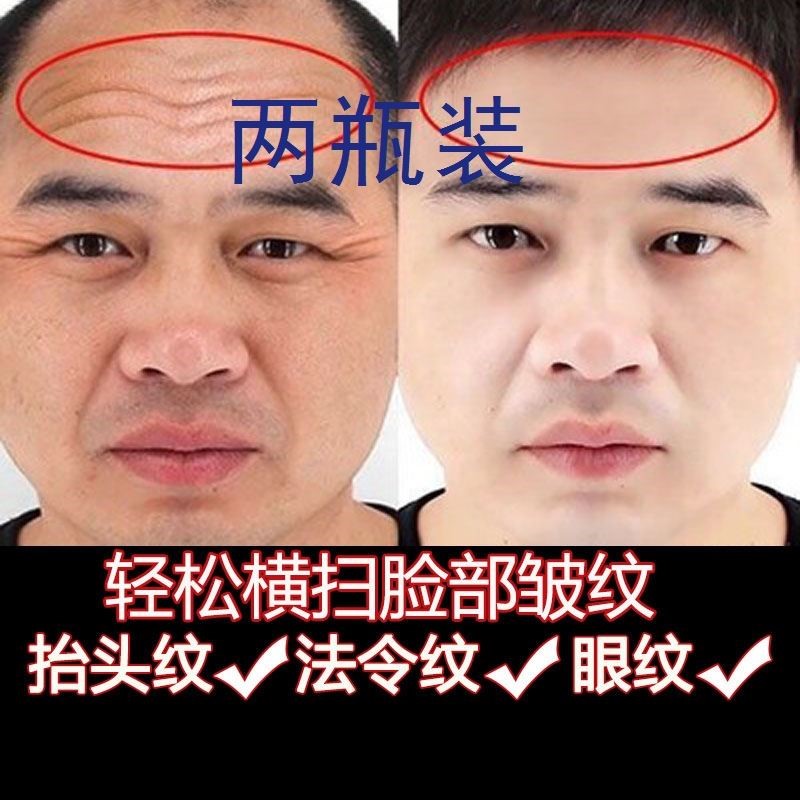 清皱纹抬头纹 男扛衰老神器扛皱面霜清皱提拉紧致男士