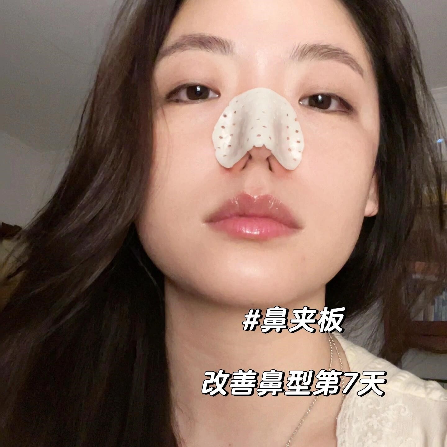 自捏塑形鼻夹大鼻孔神器热缩鼻夹高颜值鼻夹板假鼻子小工具新款女