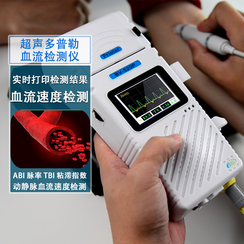 贝斯曼外周血速度检测仪超声ABI