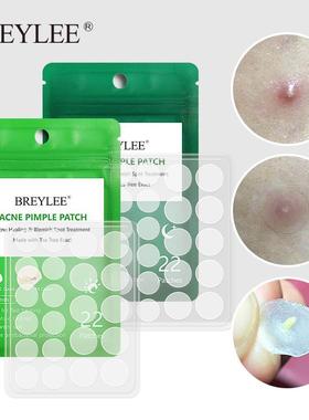 Acne Pimple Patch Stickers Acne Treatment Pimple Remover To