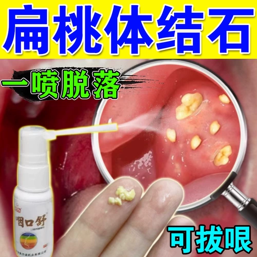 Инструмент для удаления камня миндалина криптоз