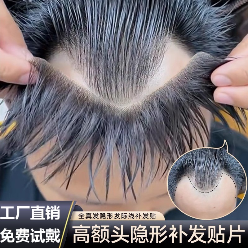 发际线假发贴假刘海假发片m形发际线贴男一片式前额补发自然真发