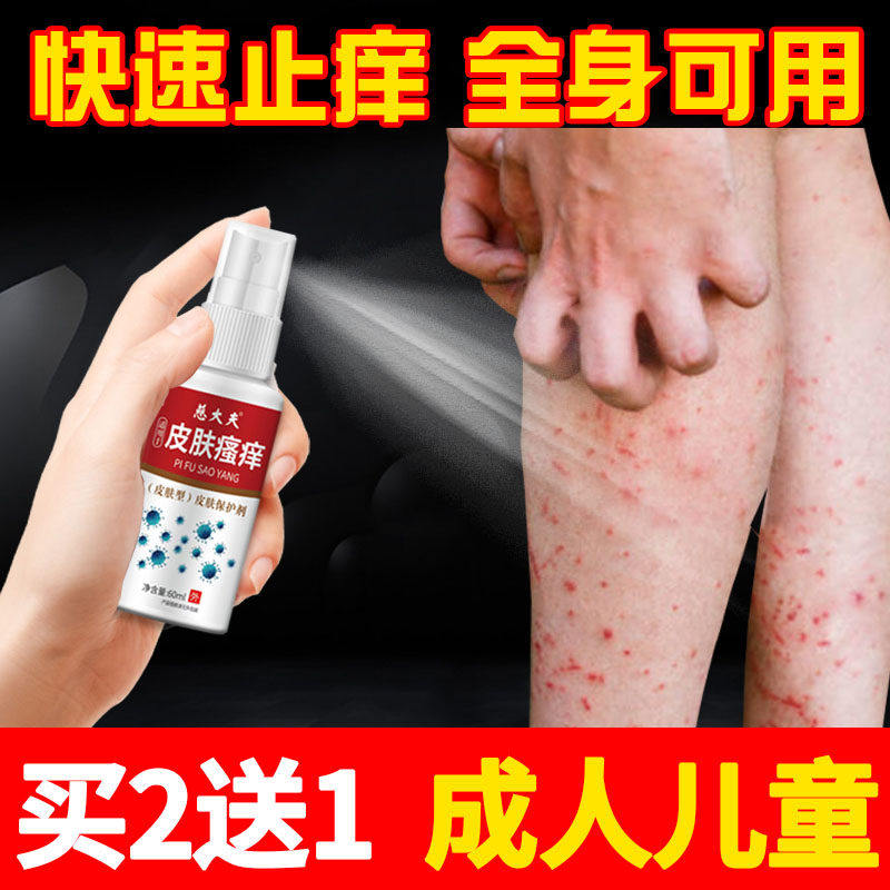 皮肤干燥瘙痒止痒喷雾小腿痒身上起红疙瘩药天气热出汗长红点