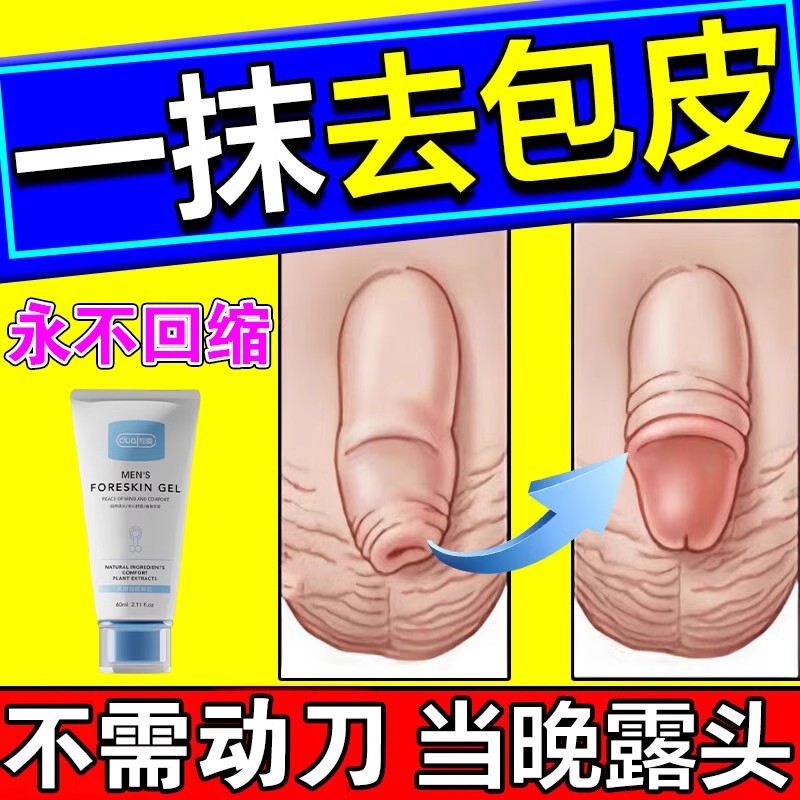 成人男用隐形阻复包皮凝