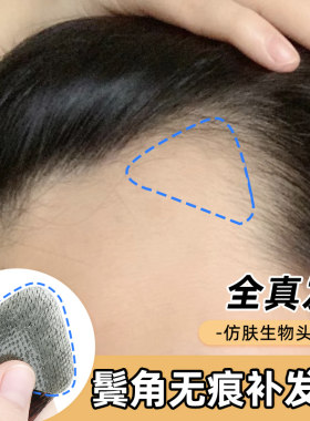 发际线假发贴男女全真发鬓角假发补发片前额遮秃m型发际线补发片