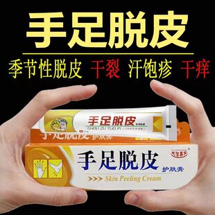 手脱皮护手修复霜季节性手掌干裂手指头裂口子维生素严重蜕皮起皮