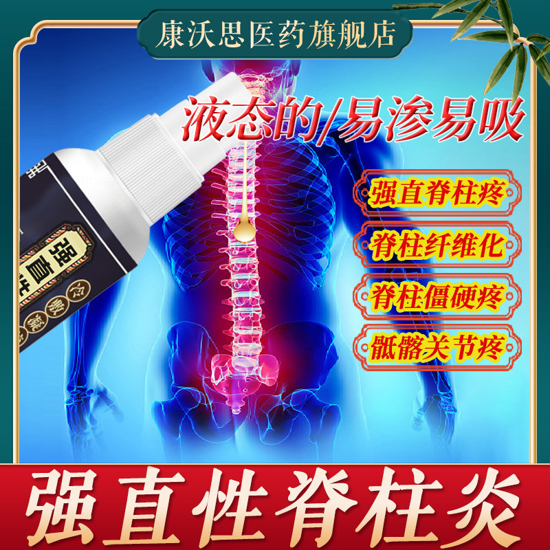强直性脊柱炎颈椎僵硬强制性脊椎炎腰背晨僵致密骶髂关节疼痛喷剂