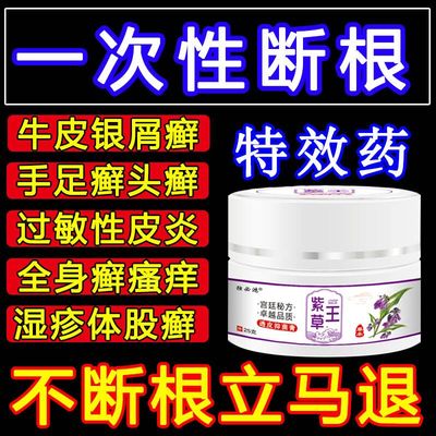 牛皮癣藓银屑病股癣手足头皮癣湿疹止痒根去皮肤专用治疗特效药膏