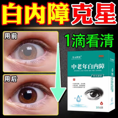 白内障专用眼药水老年人视力模糊晶状体浑浊老花眼特效护眼滴眼液