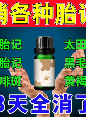 胎记去除神器脸部黑色素太田痣咖啡斑分解淡化黑色素沉淀专用精油