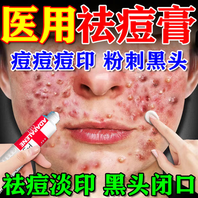 【花容美】阿达帕林凝胶0.1%*10g*1支/盒正品粉刺丘疹脓包脸部背部痤疮祛痘药膏