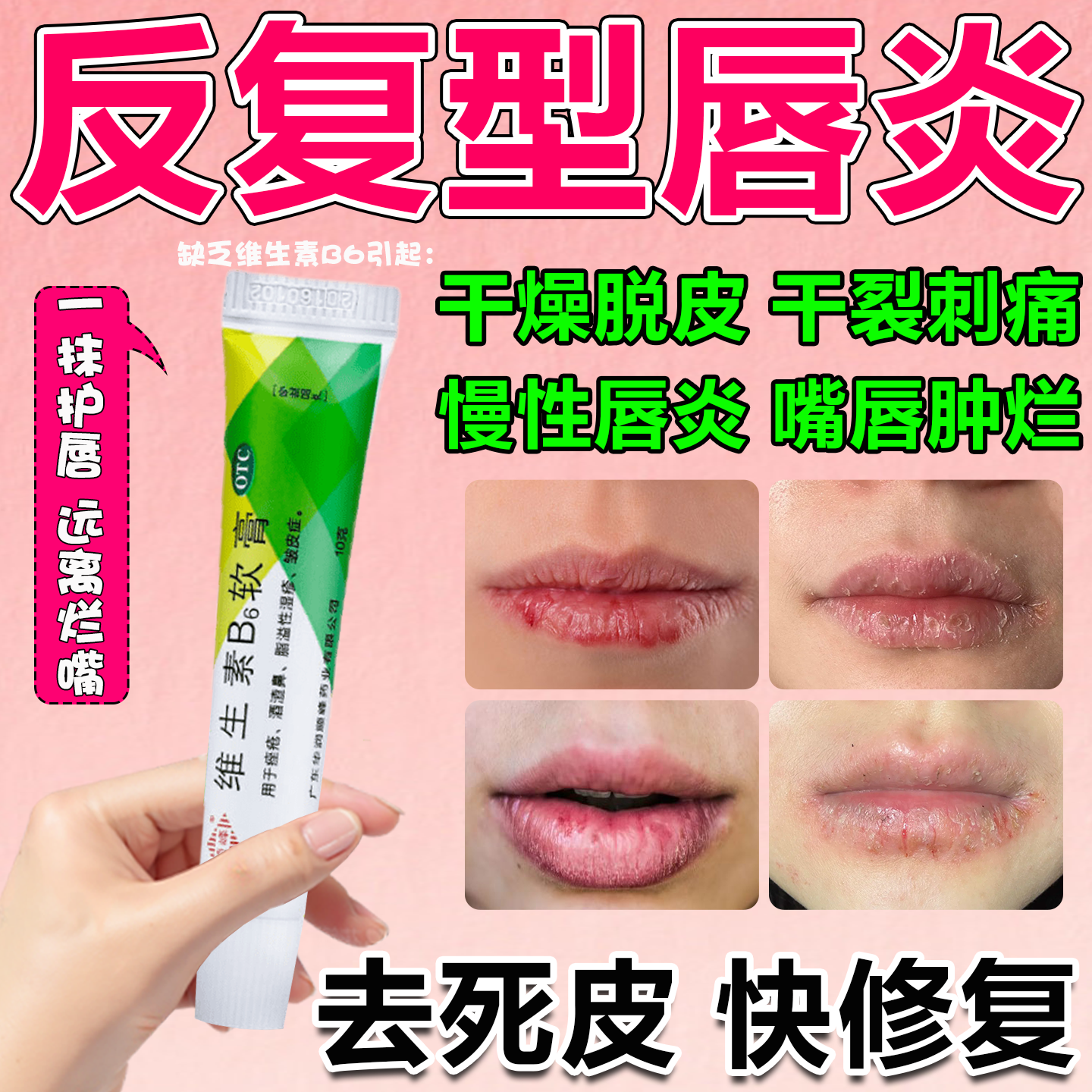 【顺峰】维生素B6软膏1.2%*10g*1支/盒唇炎专用药膏儿童唇膏嘴唇干裂脱皮医用型