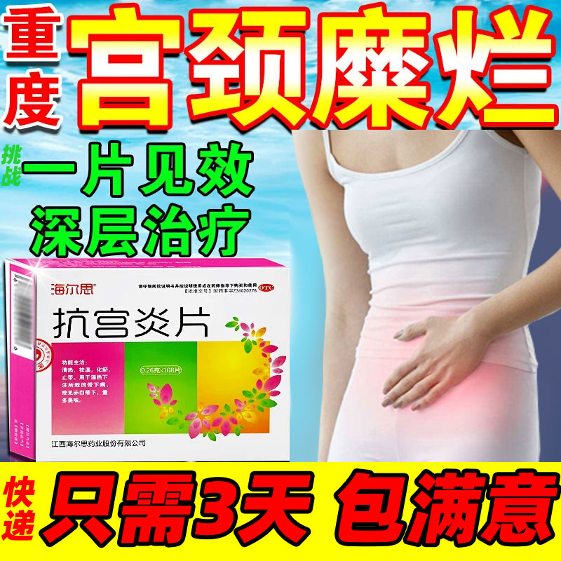 【海尔思】抗宫炎片260mg*108片/盒【宫颈糜烂重度专用中药】
