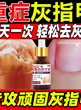 环吡酮擦剂搽剂茶灰指甲治疗专用药脚气甲沟炎治药水正品旗舰店xl