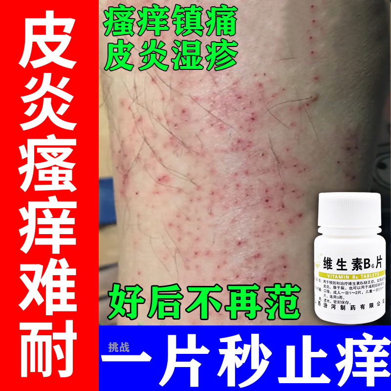【汾河】维生素B1片10mg*100片/瓶皮炎瘙痒脂溢性皮炎生发湿疹减脂