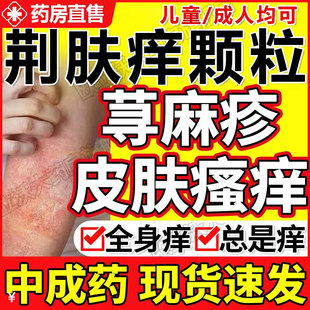 肤痒颗粒正品止痒官方旗舰店中成药成人治疗荨麻疹药冲剂非特效xl