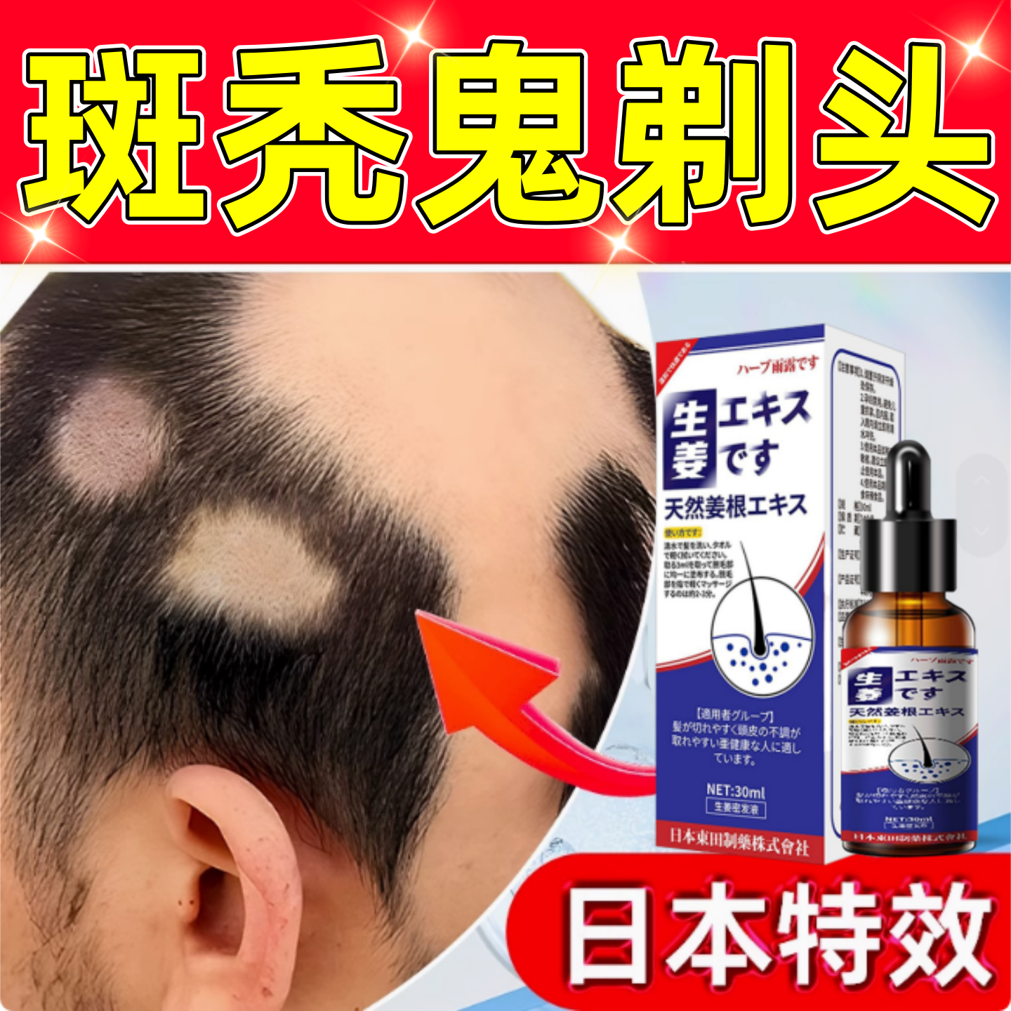 生姜密发液鬼剃头秃掉发毛囊受损修复头发再生斑秃防脱生发精华液