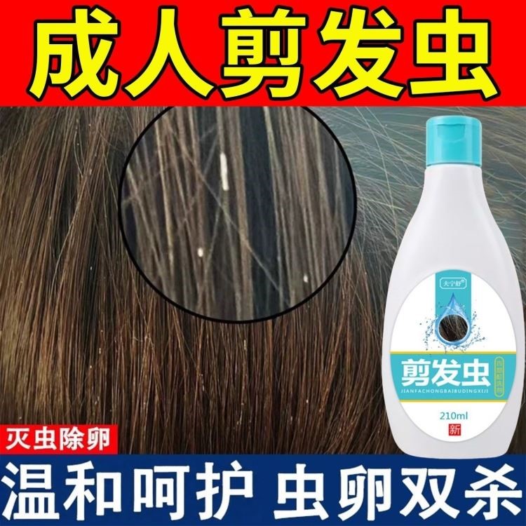 去剪发虫洗发水成人小女孩除头螨卷发虫白点的药祛屑专用液洗发露