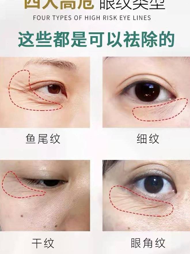 眼霜抗皱去细纹眼角皱纹修复提拉紧致抗老淡化眼部眼纹鱼尾纹除皱