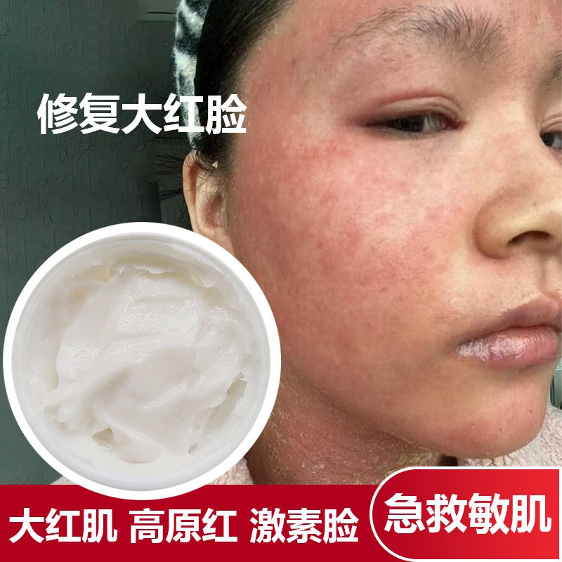 美容院厚角质层敏感肌修复特护面霜红血丝激素脸舒缓舒缓修护