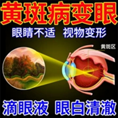 北京协和叶黄素滴眼液眼疲劳老花眼白内障黄斑病变维持视网膜功能