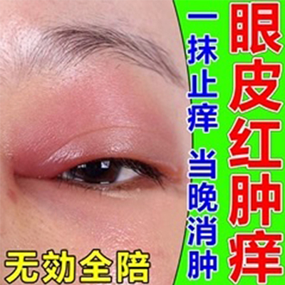 澳洲人工泪液眼疲劳眼干缓解视疲劳眼药水青霉素眼药膏珍珠明目眼