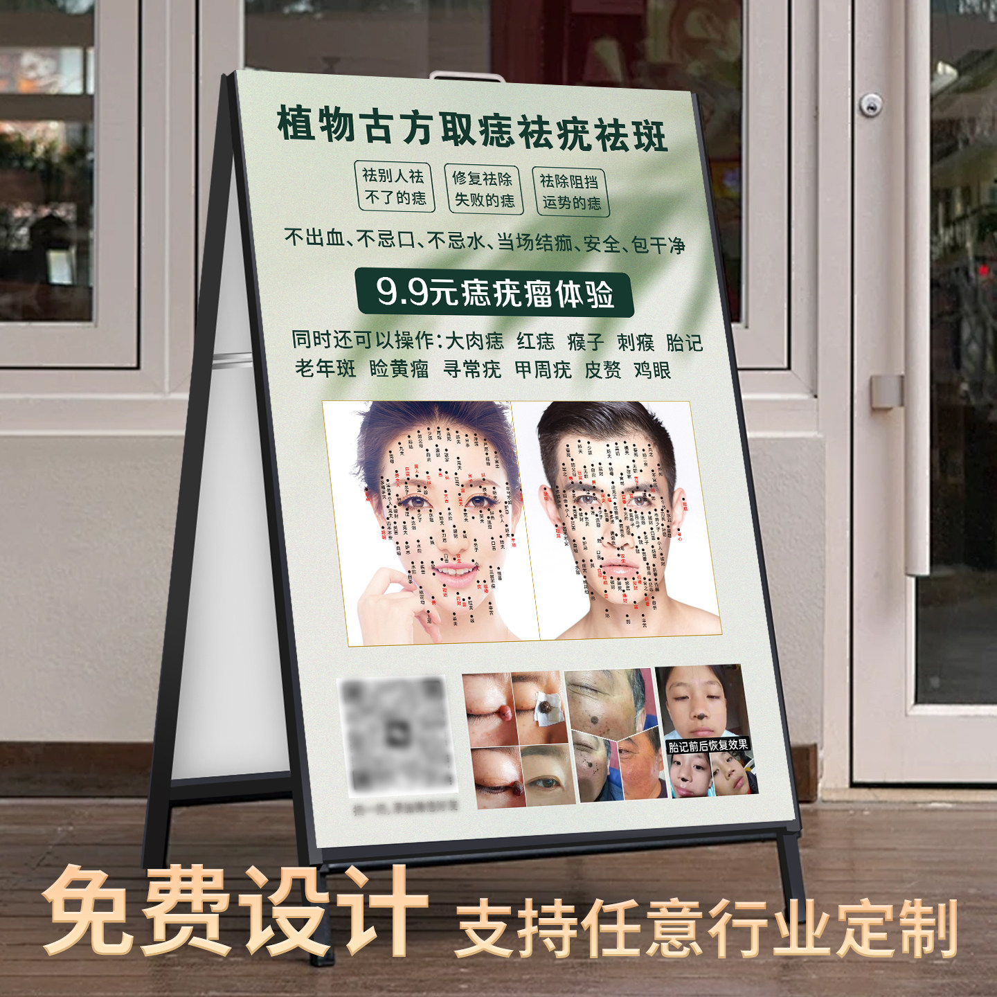 美容院展牌定制kt板展架点痣祛疣祛痘引流活动海报宣传图片设计男女面痣广告展示牌门口防风手提立牌架落地式