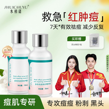 水初语祛痘精华液快速褪红控油闭口粉刺淡化祛痘印黑色素祛痘膏女