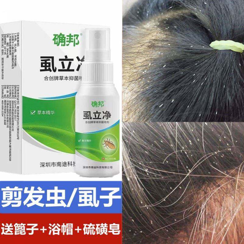 除剪发虫螨虫卷发虫小女孩头上长虱子药的药治儿童男头痒止痒专用