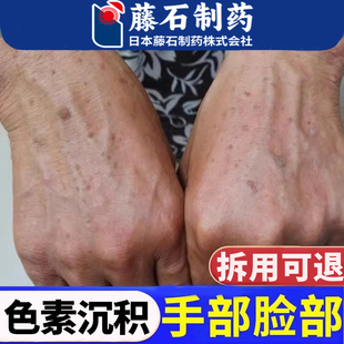 去老年斑强力可搭专用去除手背手部脸部手上旗舰店膏的一抹净YU